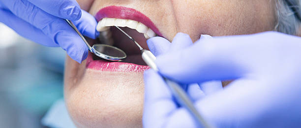 Best Emergency Dentist for Knocked-Out Tooth in Martin, SD